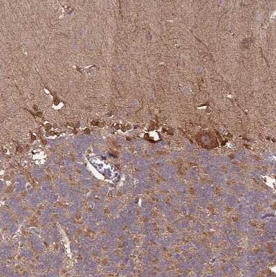 Immunohistochemistry-Paraffin: IL-17RD/SEF Antibody [NBP2-47420]