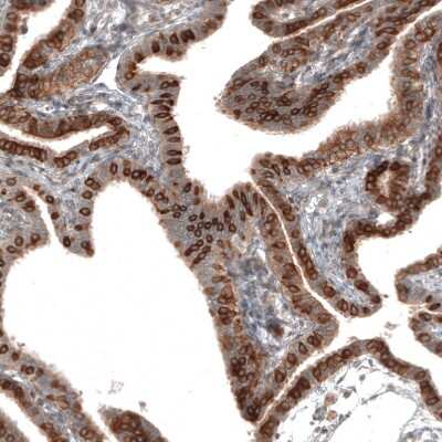 Immunohistochemistry-Paraffin: IL-17RE Antibody [NBP1-93925]