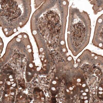 Immunohistochemistry-Paraffin: IL-17RE Antibody [NBP1-93925]