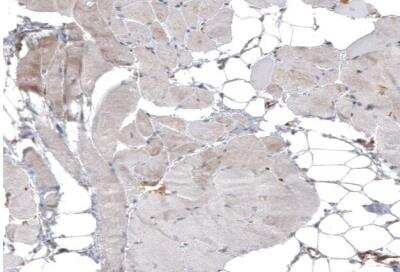 Immunohistochemistry-Paraffin: IL-17RE Antibody [NBP1-93925]