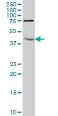 Western Blot: IL-18 BPa/IL18BP Antibody (2A9) [H00010068-M05]