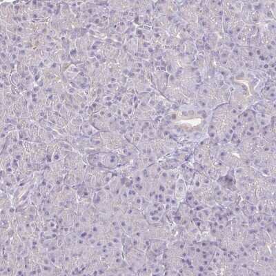 Immunohistochemistry-Paraffin: IL-18 BPa/IL18BP Antibody [NBP2-38481]