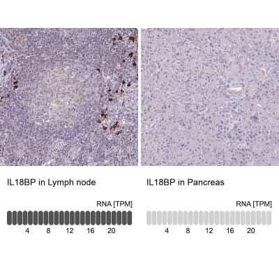 Immunohistochemistry-Paraffin: IL-18 BPa/IL18BP Antibody [NBP2-38481]