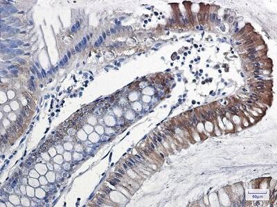 Immunohistochemistry-Paraffin: IL-18/IL-1F4 Antibody (S02-8B2) [NBP3-20042]