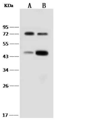 Western Blot: IL-18 R beta/IL-1 R7/ACPL Antibody (290) [NBP2-89317]