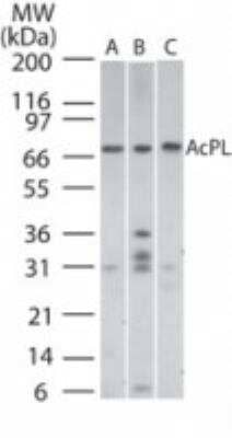 Western Blot: IL-18 R beta/IL-1 R7/ACPL Antibody [NB100-56433]