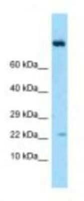 Western Blot: IL-19 Antibody [NBP1-98448]