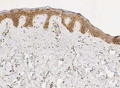 Immunohistochemistry-Paraffin: IL-1ra/IL-1F3/IL1RN Antibody (005) [NBP2-89195]