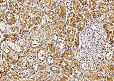 Immunohistochemistry-Paraffin: IL-1ra/IL-1F3/IL1RN Antibody (005) [NBP2-89195]