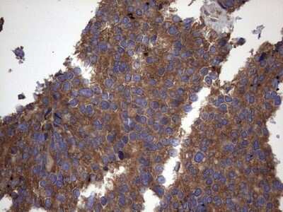 Immunohistochemistry: IL-1ra/IL-1F3/IL1RN Antibody (OTI2B1) [NBP2-45408]