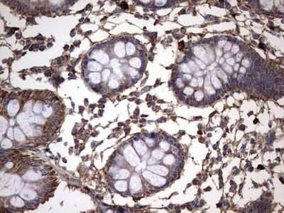 Immunohistochemistry: IL-1ra/IL-1F3/IL1RN Antibody (OTI2B1) [NBP2-45408]