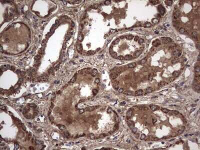 Immunohistochemistry: IL-1ra/IL-1F3/IL1RN Antibody (OTI2B1) [NBP2-45408]
