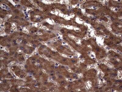 Immunohistochemistry: IL-1ra/IL-1F3/IL1RN Antibody (OTI2B1) [NBP2-45408]
