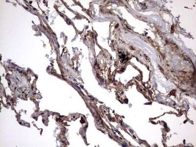 Immunohistochemistry: IL-1ra/IL-1F3/IL1RN Antibody (OTI2B1) [NBP2-45408]