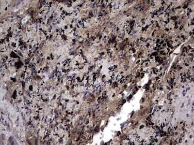 Immunohistochemistry: IL-1ra/IL-1F3/IL1RN Antibody (OTI2B1) [NBP2-45408]