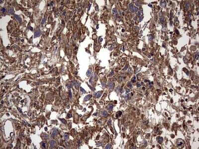 Immunohistochemistry: IL-1ra/IL-1F3/IL1RN Antibody (OTI2B1) [NBP2-45408]