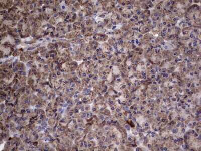 Immunohistochemistry: IL-1ra/IL-1F3/IL1RN Antibody (OTI2B1) [NBP2-45408]