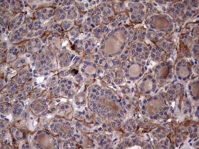 Immunohistochemistry: IL-1ra/IL-1F3/IL1RN Antibody (OTI2B1) [NBP2-45408]