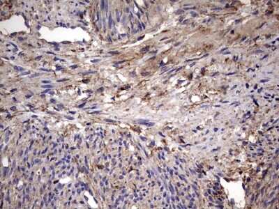 Immunohistochemistry: IL-1ra/IL-1F3/IL1RN Antibody (OTI2B1) [NBP2-45408]