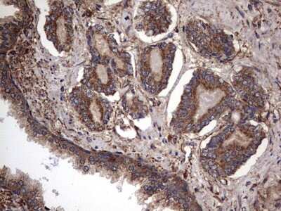 Immunohistochemistry: IL-1ra/IL-1F3/IL1RN Antibody (OTI2B1) [NBP2-45408]