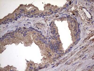 Immunohistochemistry: IL-1ra/IL-1F3/IL1RN Antibody (OTI2B1) [NBP2-45408]