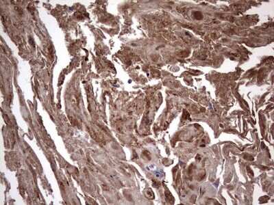 Immunohistochemistry: IL-1ra/IL-1F3/IL1RN Antibody (OTI2B1) [NBP2-45408]