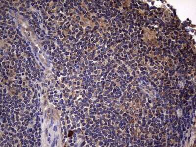 Immunohistochemistry: IL-1ra/IL-1F3/IL1RN Antibody (OTI2B1) [NBP2-45408]