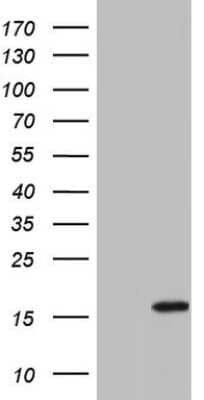 Western Blot: IL-1ra/IL-1F3/IL1RN Antibody (OTI2B1) [NBP2-45408]