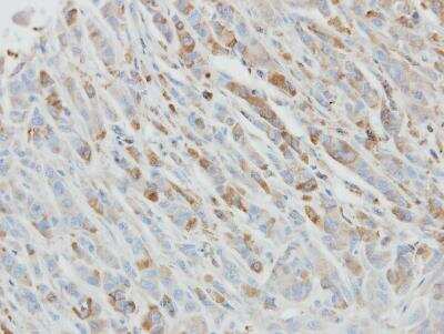 Immunohistochemistry-Paraffin: IL-1ra/IL-1F3/IL1RN Antibody [NBP1-32568]
