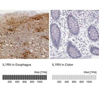 Immunohistochemistry-Paraffin: IL-1ra/IL-1F3/IL1RN Antibody [NBP1-81616]