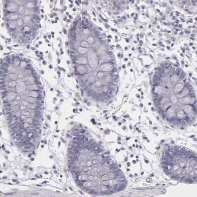 Immunohistochemistry-Paraffin: IL-1ra/IL-1F3/IL1RN Antibody [NBP1-81616]