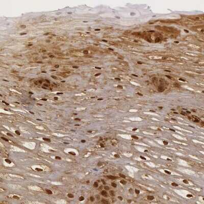Immunohistochemistry-Paraffin: IL-1ra/IL-1F3/IL1RN Antibody [NBP1-81616]