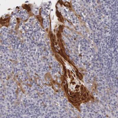Immunohistochemistry-Paraffin: IL-1ra/IL-1F3/IL1RN Antibody [NBP1-81616]