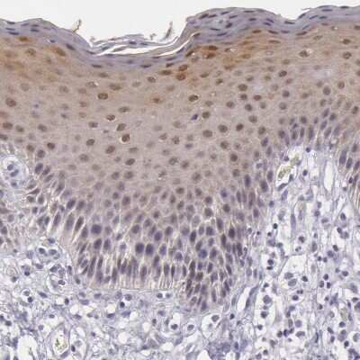 Immunohistochemistry-Paraffin: IL-1ra/IL-1F3/IL1RN Antibody [NBP1-81616]