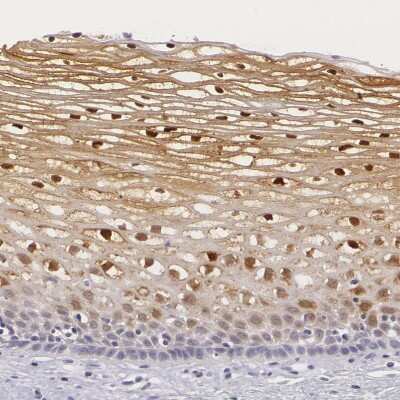 Immunohistochemistry-Paraffin: IL-1ra/IL-1F3/IL1RN Antibody [NBP1-81616]