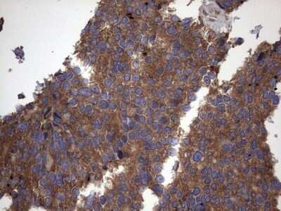 Immunohistochemistry: IL-1ra/IL-1F3/IL1RN Antibody (OTI2B1) - Azide and BSA Free [NBP2-71022]