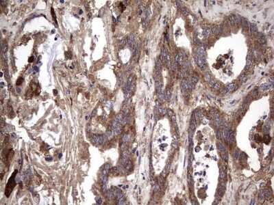 Immunohistochemistry: IL-1ra/IL-1F3/IL1RN Antibody (OTI2B1) - Azide and BSA Free [NBP2-71022]