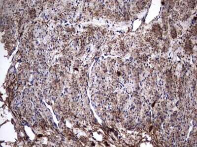Immunohistochemistry: IL-1ra/IL-1F3/IL1RN Antibody (OTI2B1) - Azide and BSA Free [NBP2-71022]