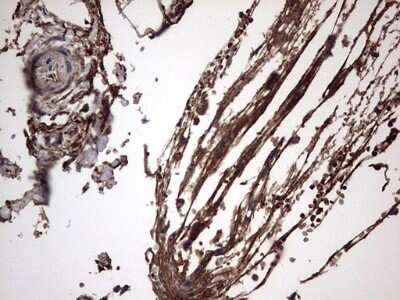 Immunohistochemistry: IL-1ra/IL-1F3/IL1RN Antibody (OTI2B1) - Azide and BSA Free [NBP2-71022]
