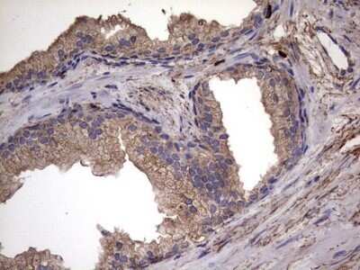Immunohistochemistry: IL-1ra/IL-1F3/IL1RN Antibody (OTI2B1) - Azide and BSA Free [NBP2-71022]