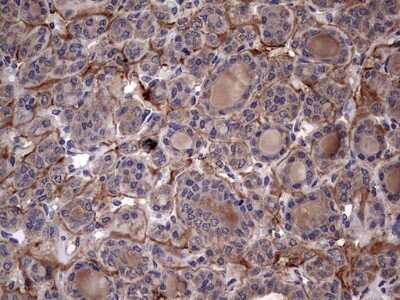 Immunohistochemistry: IL-1ra/IL-1F3/IL1RN Antibody (OTI2B1) - Azide and BSA Free [NBP2-71022]