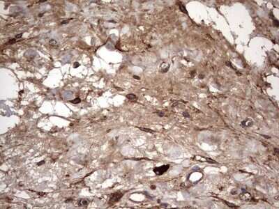 Immunohistochemistry: IL-1ra/IL-1F3/IL1RN Antibody (OTI2B1) - Azide and BSA Free [NBP2-71022]
