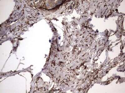 Immunohistochemistry: IL-1ra/IL-1F3/IL1RN Antibody (OTI2B1) - Azide and BSA Free [NBP2-71022]