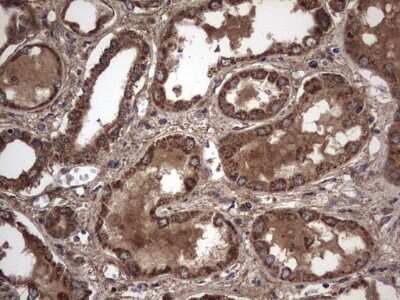 Immunohistochemistry: IL-1ra/IL-1F3/IL1RN Antibody (OTI2B1) - Azide and BSA Free [NBP2-71022]