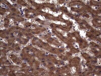Immunohistochemistry: IL-1ra/IL-1F3/IL1RN Antibody (OTI2B1) - Azide and BSA Free [NBP2-71022]