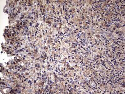 Immunohistochemistry: IL-1ra/IL-1F3/IL1RN Antibody (OTI2B1) - Azide and BSA Free [NBP2-71022]