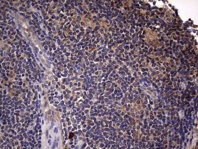 Immunohistochemistry: IL-1ra/IL-1F3/IL1RN Antibody (OTI2B1) - Azide and BSA Free [NBP2-71022]