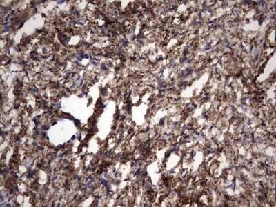 Immunohistochemistry: IL-1ra/IL-1F3/IL1RN Antibody (OTI2B1) - Azide and BSA Free [NBP2-71022]