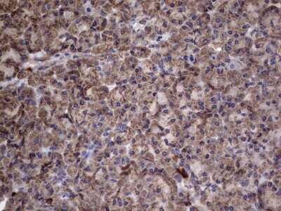 Immunohistochemistry: IL-1ra/IL-1F3/IL1RN Antibody (OTI2B1) - Azide and BSA Free [NBP2-71022]