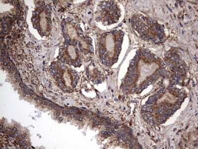 Immunohistochemistry: IL-1ra/IL-1F3/IL1RN Antibody (OTI2B1) - Azide and BSA Free [NBP2-71022]